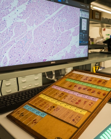 A pathology screen next to slides