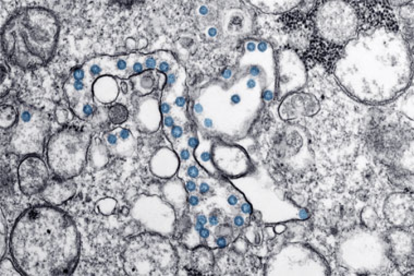 COVID-19 coronavirus isolate, colorized in blue