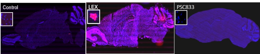 Brain sections showing the effect of the drug Lexiscan